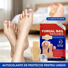 【Set 5 Pachete (Total 105 Plasturi)】Plasturi Tratament pentru Ciuperca Unghiei – Combate Infecțiile Bacteriene, Reface Structura și Culoarea Unghiilor de la Mâini și Picioare